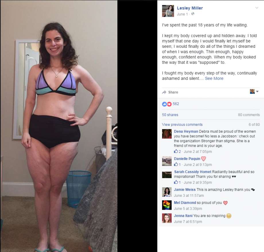 Se pone el bikini por primera vez y se hace viral