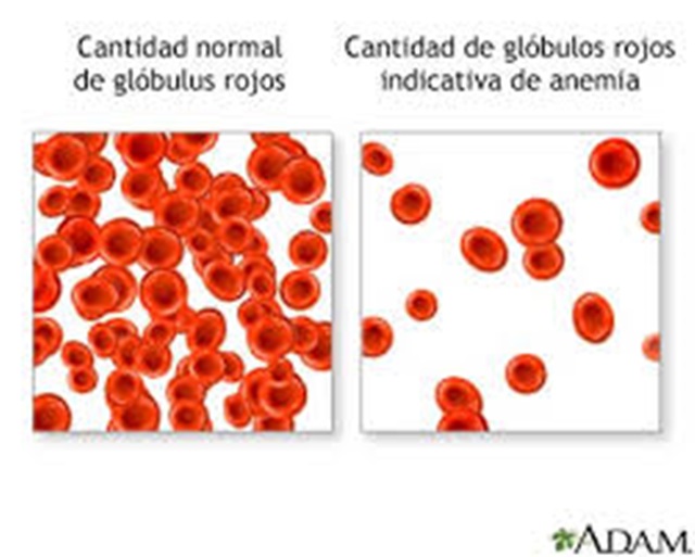 Remedios contra la anemia 