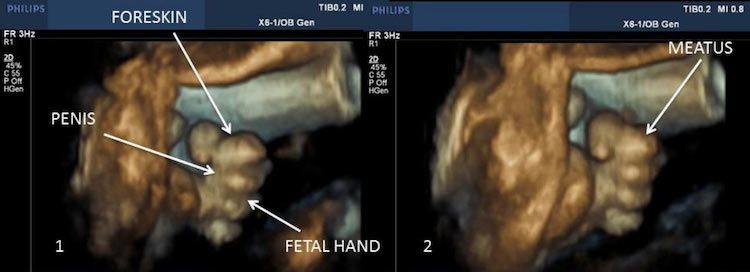 Imágenes demuestran que el feto se masturba dentro de su madre