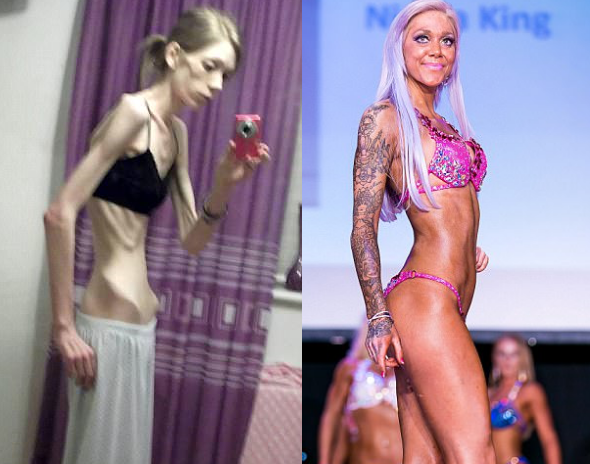 De estar a punto de morir de anorexia a ser campeona de culturismo