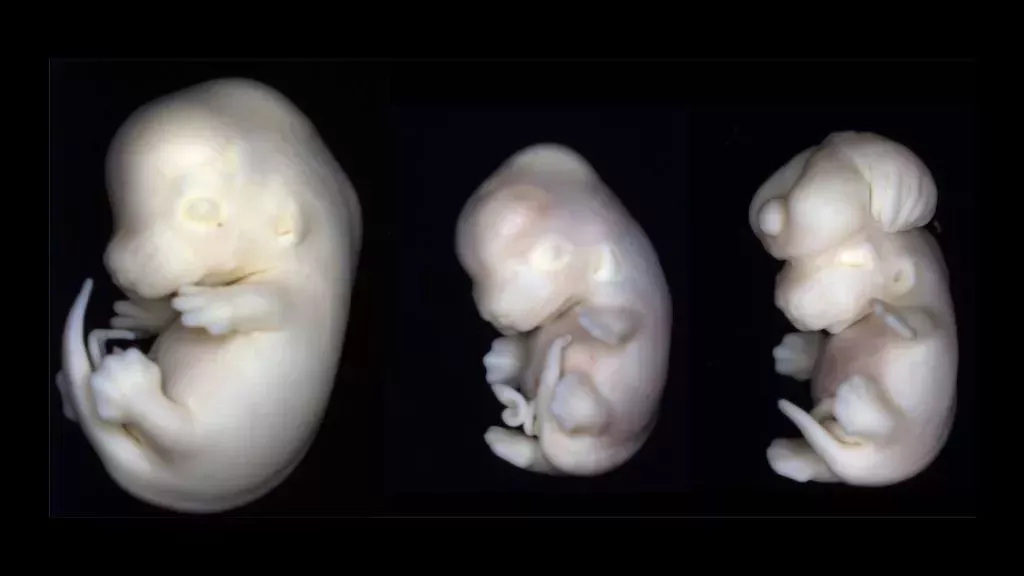 Los minicerebros muestran cómo un medicamento común congela la división celular en el útero, causando defectos de nacimiento