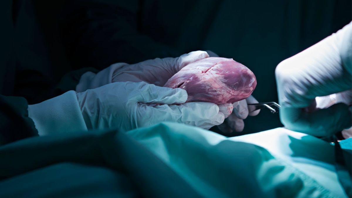 Los corazones "reanimados" pueden trasplantarse con éxito y podrían ampliar la reserva de donantes
