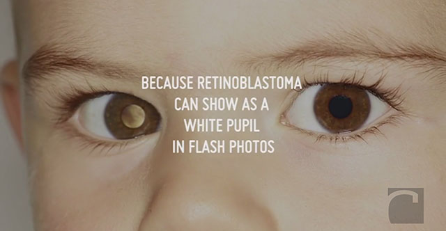 Detectar cáncer de retina con flash