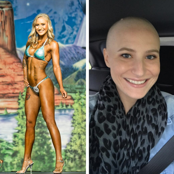 Amante del fitness muestra cómo el cáncer cambia su cuerpo 