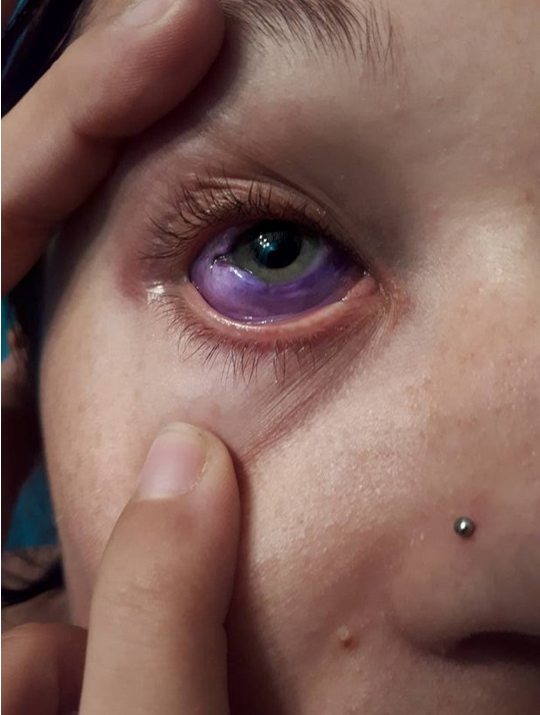 Modelo se tatua el ojo 