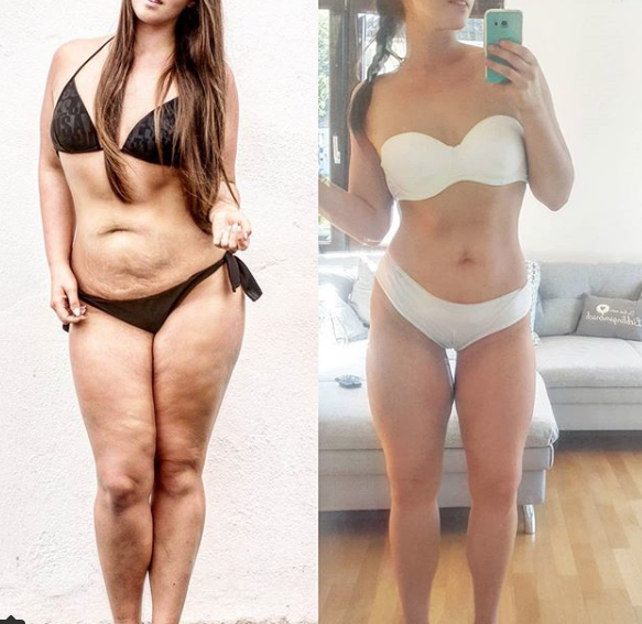 Adelgaza 45 kilos con la dieta FAST