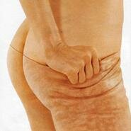  Combate la celulitis desde la alimentación