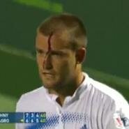 El increíble vídeo del tenista que se pega 11 raquetazos en la cabeza en pleno partido
