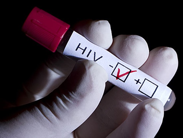 Buenas noticias: los científicos están a punto de controlar el VIH