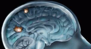 Puedes tener parásitos en el cerebro y no lo sabes