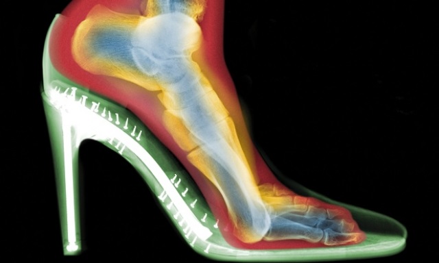 Por qué utilizar tacones es perjudicial para nuestra salud Por qué utilizar tacones es perjudicial para nuestra salud