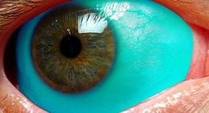 La nueva y peligrosa moda de tatuarse los ojos