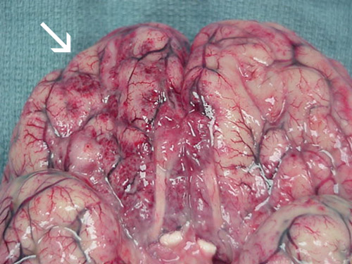 La ameba que te come el cerebro poco a poco La ameba que te come el cerebro poco a poco