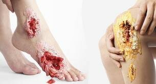 Impactante campaña publicitaria contra el azúcar