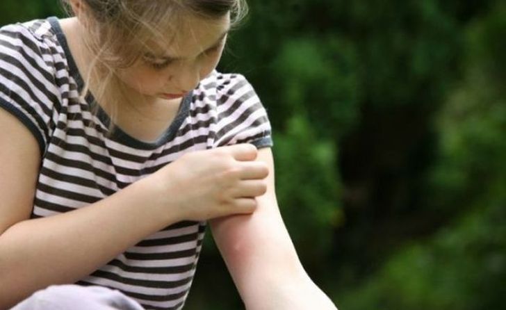 ¿Cuáles son los mejores remedios caseros contra los mosquitos?