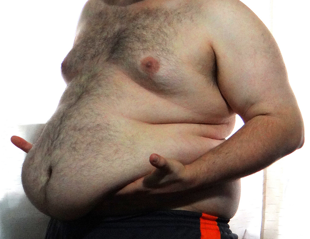 Asocian una gran barriga al cáncer de próstata mortal Asocian una gran barriga al cáncer de próstata mortal