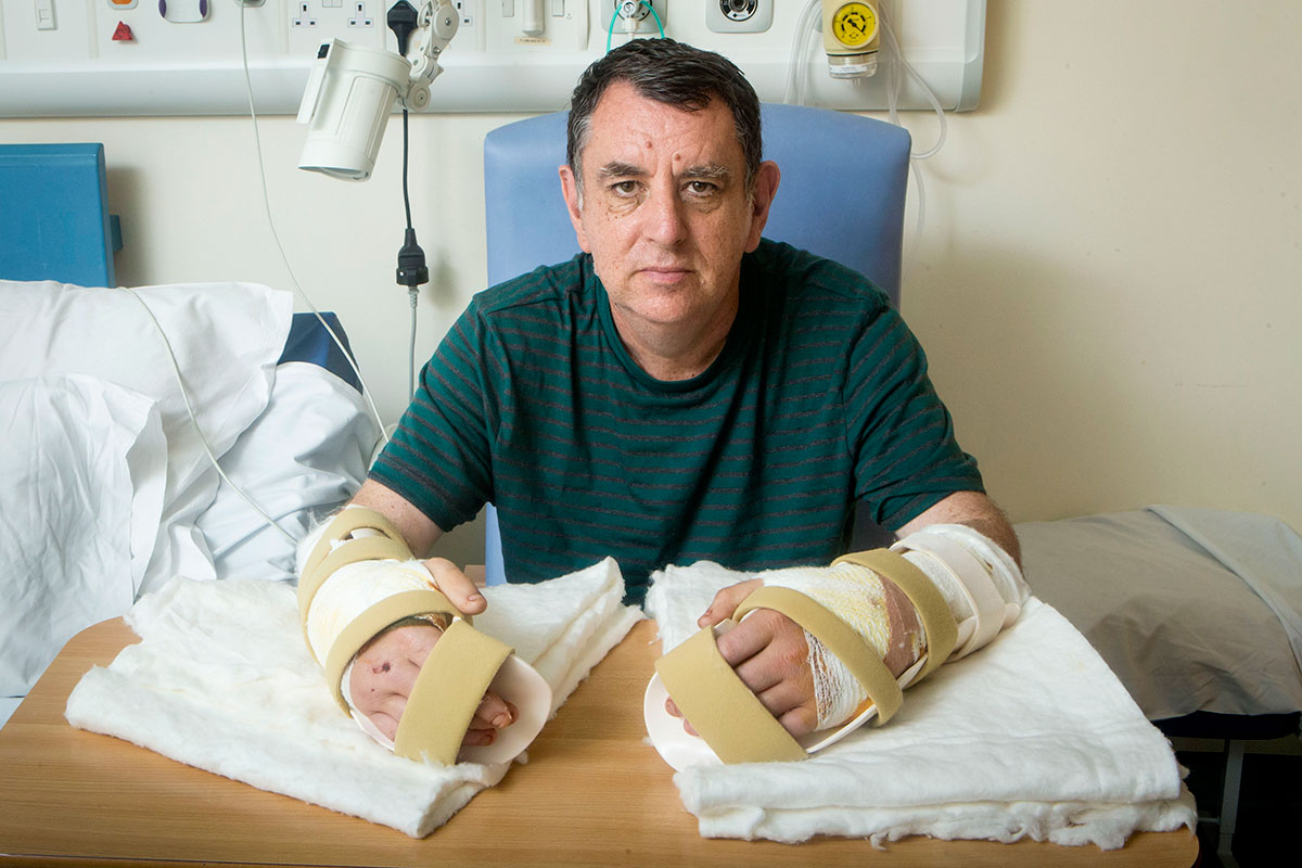 Realizado con éxito el primer transplante de las dos manos Realizado con éxito el primer transplante de las dos manos