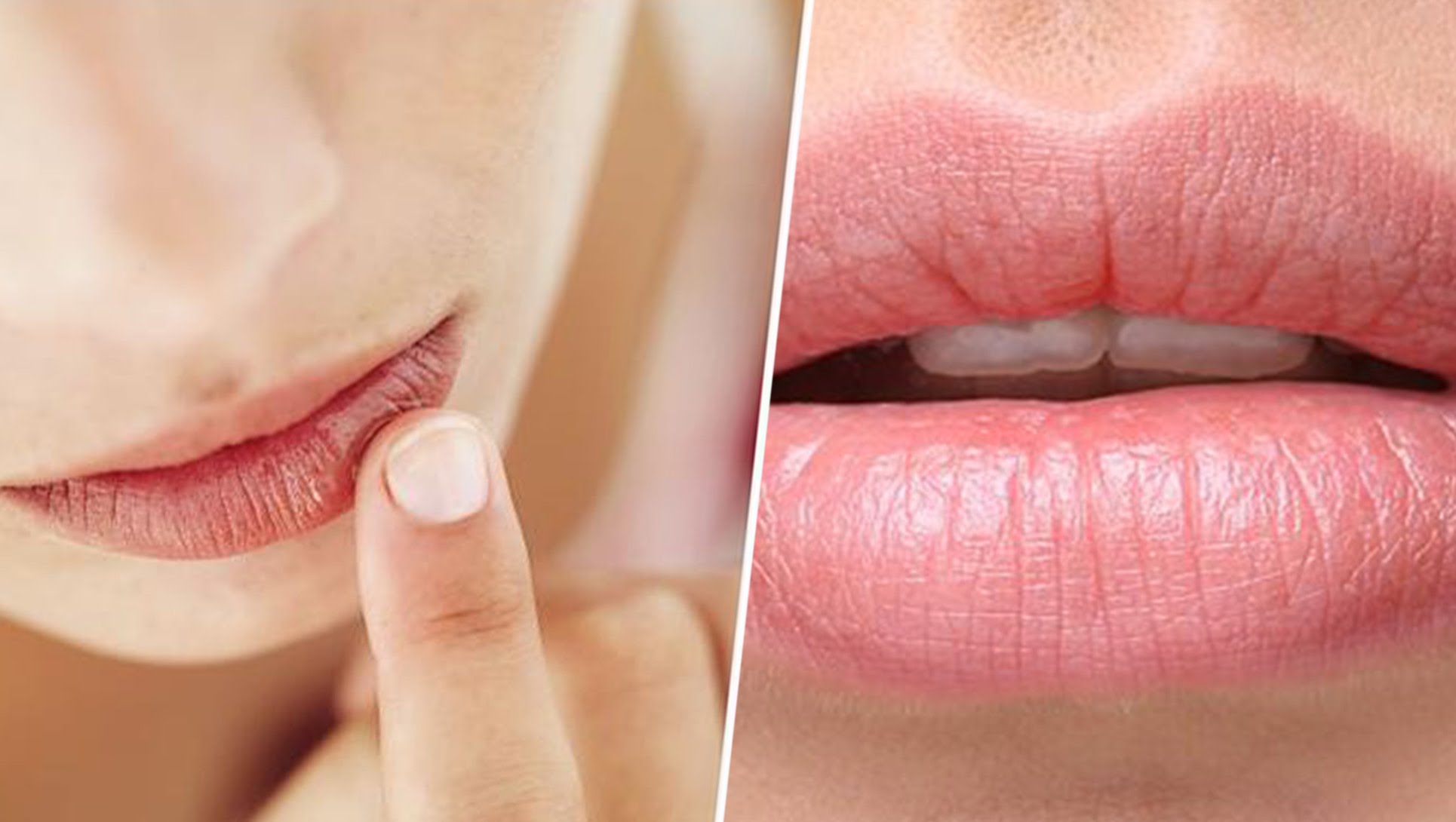 Así es tu estado de salud según el color de tus labios