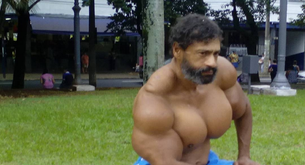 Se inyecta aceite para conseguir los músculos de Hulk