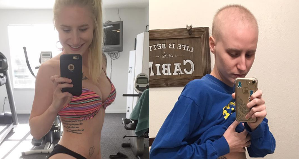 Esta deportista está compartiendo en Instagram su cambio físico debido al cáncer Esta deportista está compartiendo en Instagram su cambio físico debido al cáncer
