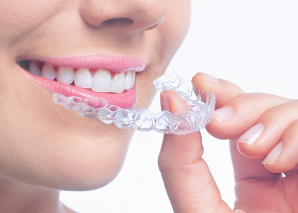 invisalign