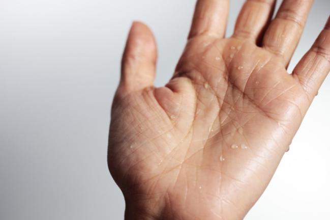 como evitar que suden las manos