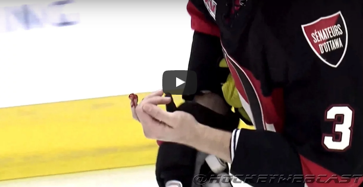 Este jugador de hockey recibió un golpe que le cortó el dedo en dos