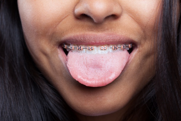 Lo que tu lengua dice de tu salud