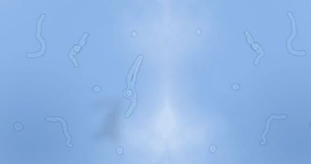 No entres en pánico con los puntos flotantes en los ojos No entres en pánico con los puntos flotantes en los ojos