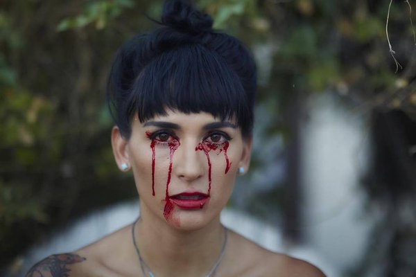 7 enfermedades raras que no creerás que existen 7 enfermedades raras que no creerás que existen