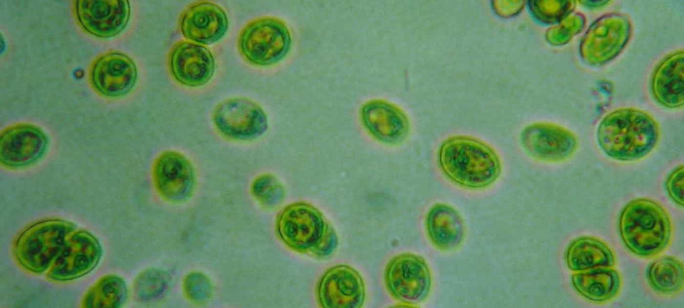 ¿Cuáles son las contraindicaciones de la chlorella? ¿Cuáles son las contraindicaciones de la chlorella?