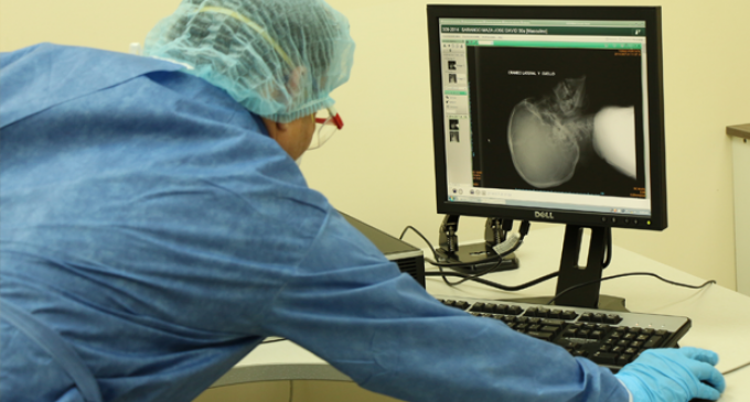 Le introducen por error un cerebro en el abdomen Le introducen por error un cerebro en el abdomen