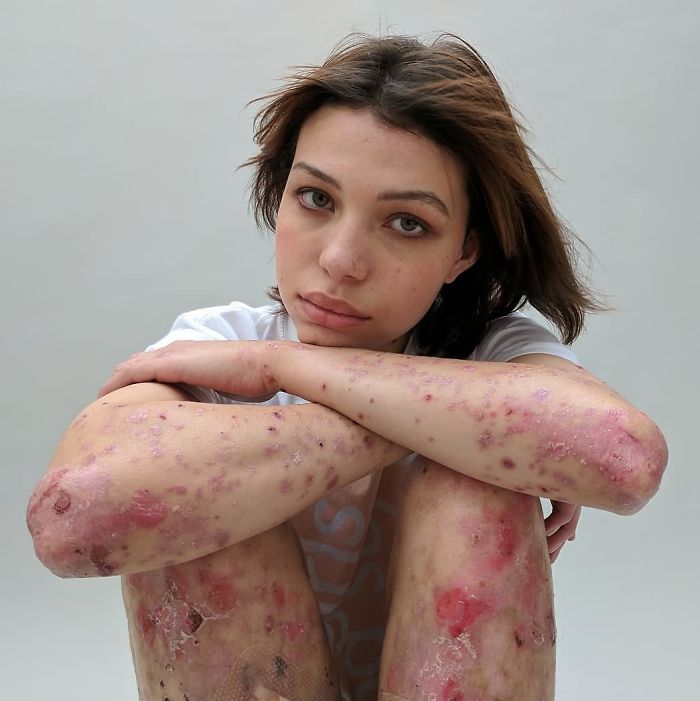 Este proyecto revela los distintos motivos por los que la gente tiene cicatrices