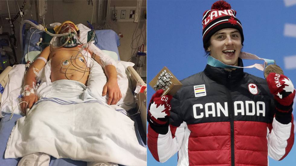 Mark McMorris: de estar al borde la muerte a ganar la medalla de bronce