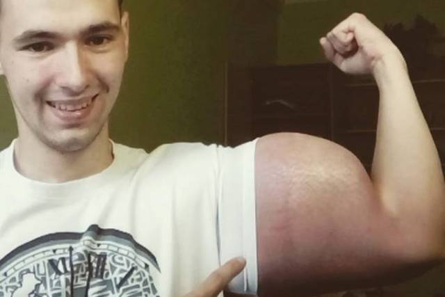 El Popeye ruso cree que “morirá pronto” El Popeye ruso cree que “morirá pronto”