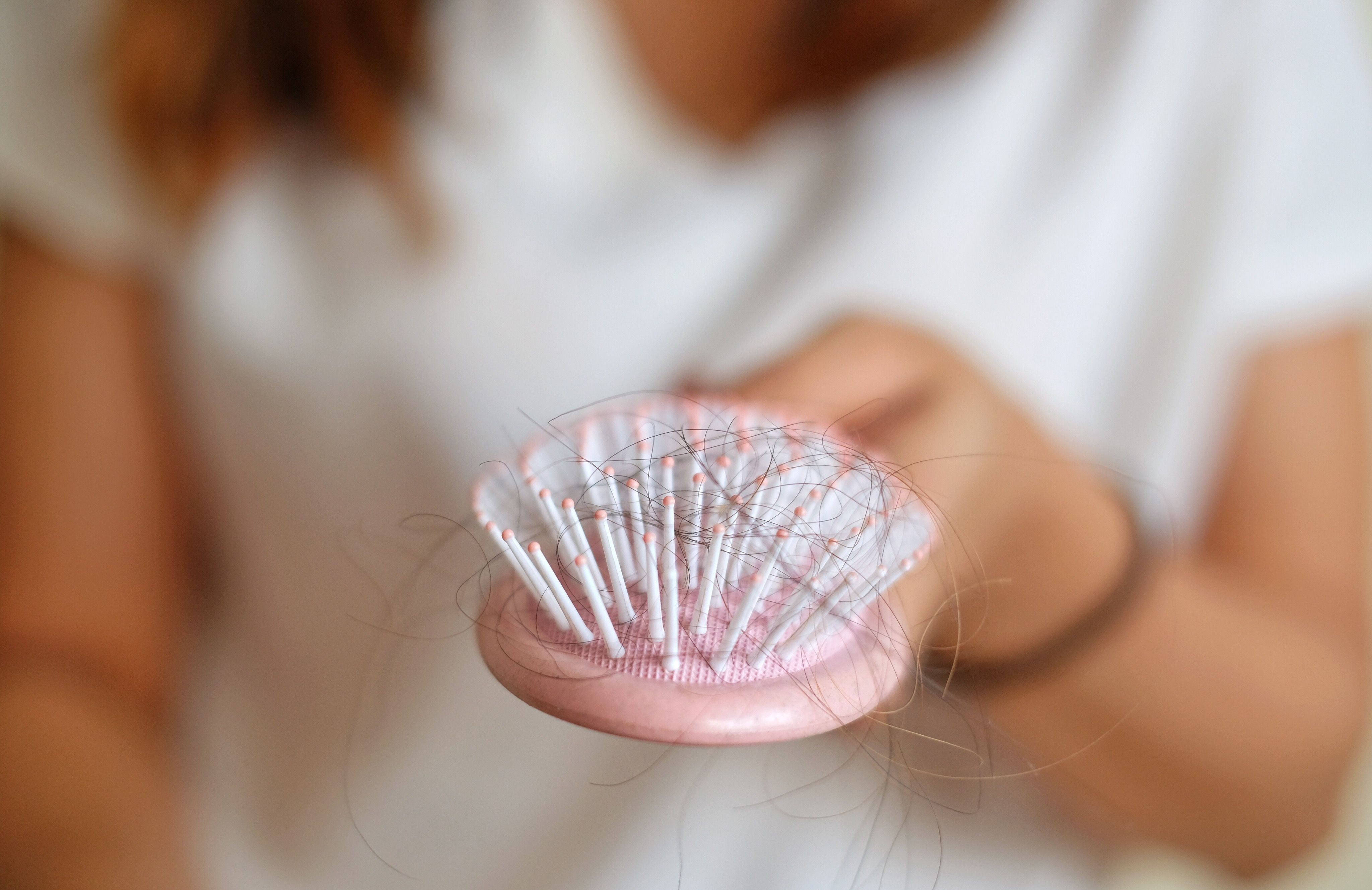 Por qué algunas personas que tuvieron COVID-19 están lidiando con la pérdida de cabello, según los médicos