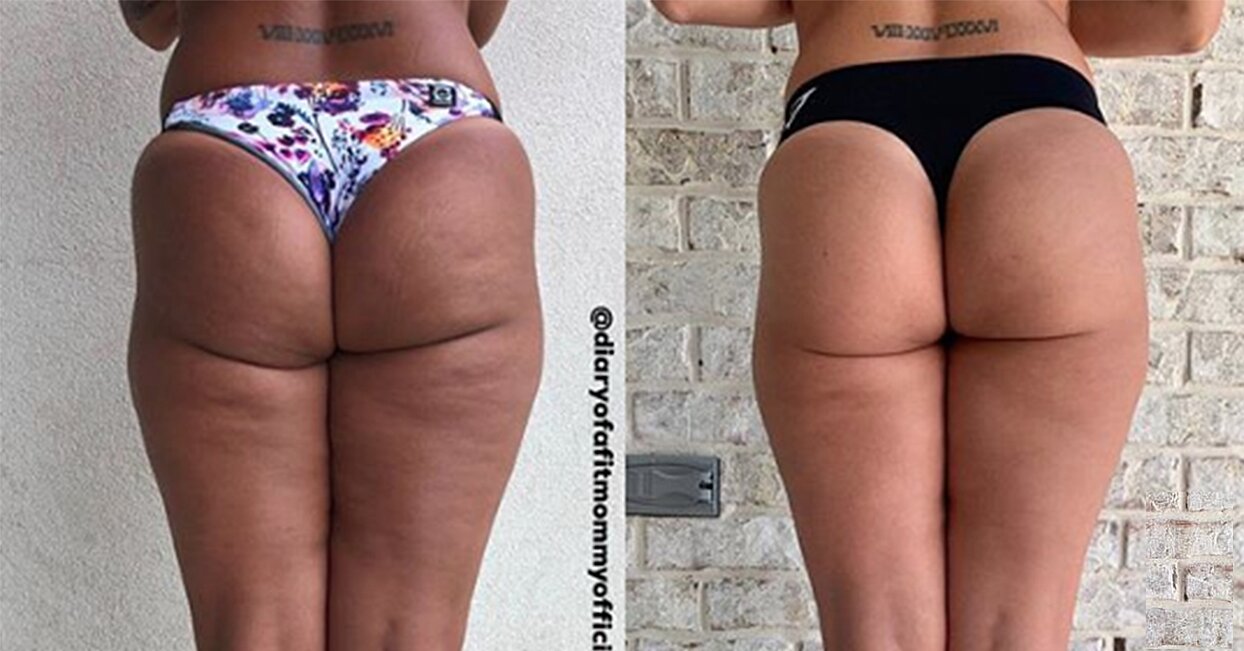 Sia Cooper señaló un gran problema con las fotos de "antes y después" en el programa.