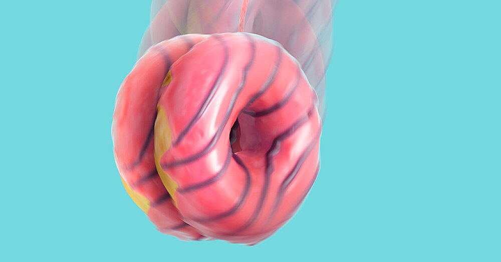 Cómo dejar de hacer dieta Yo-Yo de una vez por todas