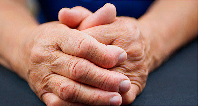 Progresión de la artritis reumatoide