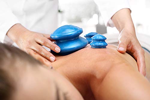 4 ventosas chinas ANTI-CELLULITE accesorio masajeador azul 4 ventosas chinas ANTI-CELLULITE accesorio masajeador azul