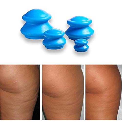 4 ventosas chinas ANTI-CELLULITE accesorio masajeador azul