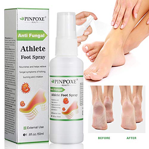 Athletes Foot Spray, Spray para pies, Pies Fungus Treatment, Pies Treatment, Ayuda a tratar y restaurar la apariencia del pie infectado con hongos