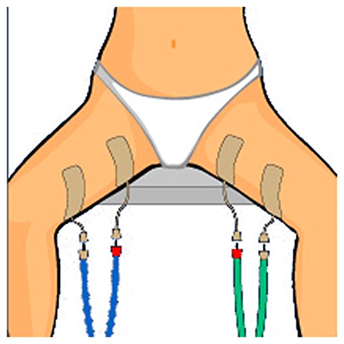 CefarCompex Cefar Compex Electrodes Stimtrode Wirep by CefarCompex Cefar Compex Electrodes Stimtrode Wirep by