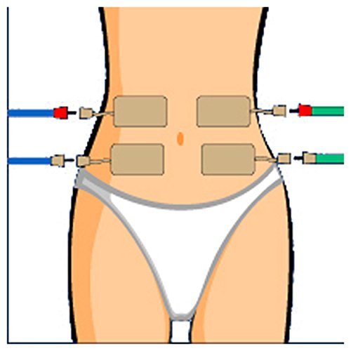CefarCompex Cefar Compex Electrodes Stimtrode Wirep by CefarCompex Cefar Compex Electrodes Stimtrode Wirep by