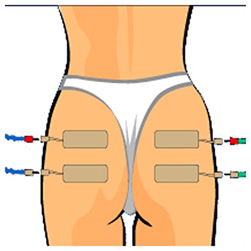 CefarCompex Cefar Compex Electrodes Stimtrode Wirep by CefarCompex Cefar Compex Electrodes Stimtrode Wirep by