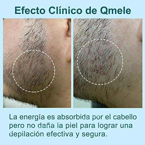 IPL Depiladora Luz Pulsada para Mujeres Veme 500,000 Disparos Maquina Depilacion Laser Permanente Refrigeración ICE Uso Doméstico para Cara, Axilas, Brazos, Pecho, Espalda, Línea de Bikini y Piernas IPL Depiladora Luz Pulsada para Mujeres Veme 500,000 Disparos Maquina Depilacion Laser Permanente Refrigeración ICE Uso Doméstico para Cara, Axilas, Brazos, Pecho, Espalda, Línea de Bikini y Piernas