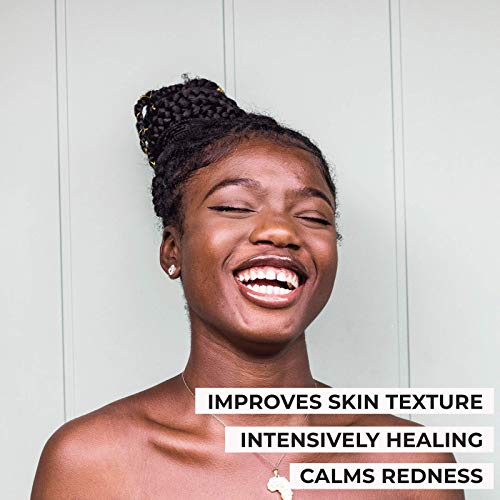 Jabón Africano Natural Negro Facial Cuerpo y Manos Limpieza Exfoliante Vegano Detox Para Acné Psoriasis Eccema Minimiza Poros Puntos Negros con Aceites Esenciales Terapéuticos Para Hombre Mujer 340 Gr Jabón Africano Natural Negro Facial Cuerpo y Manos Limpieza Exfoliante Vegano Detox Para Acné Psoriasis Eccema Minimiza Poros Puntos Negros con Aceites Esenciales Terapéuticos Para Hombre Mujer 340 Gr
