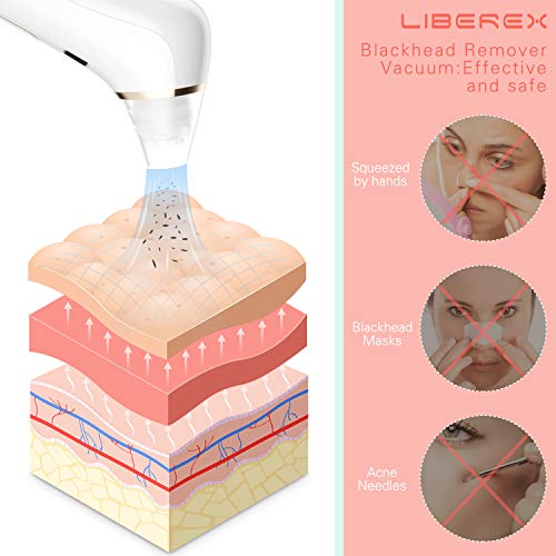 Liberex Limpiador de poros, 4 cabezas de succión con 5 niveles de intensidad, limpiador facial de poros, 2 lámparas de reparación de piel, recargable por USB