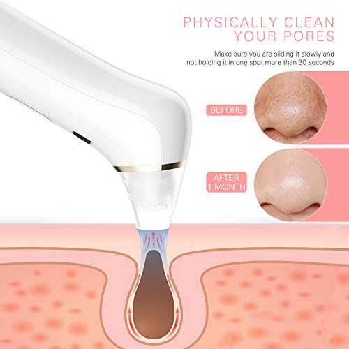 Liberex Limpiador de poros, 4 cabezas de succión con 5 niveles de intensidad, limpiador facial de poros, 2 lámparas de reparación de piel, recargable por USB Liberex Limpiador de poros, 4 cabezas de succión con 5 niveles de intensidad, limpiador facial de poros, 2 lámparas de reparación de piel, recargable por USB