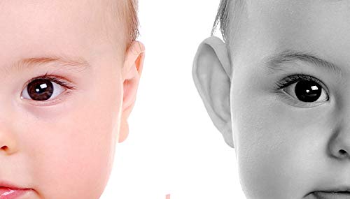 Otostick Bebé | Correctores estéticos para orejas separadas | Contiene 8 correctores + 1 gorro | A partir de 3 meses.